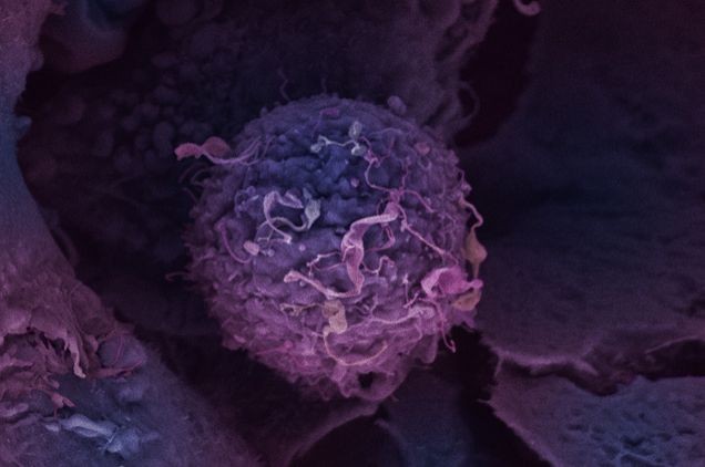 癌症生物标志物 癌症生物标志物